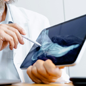 ortopedia-traumatología-CMSJ